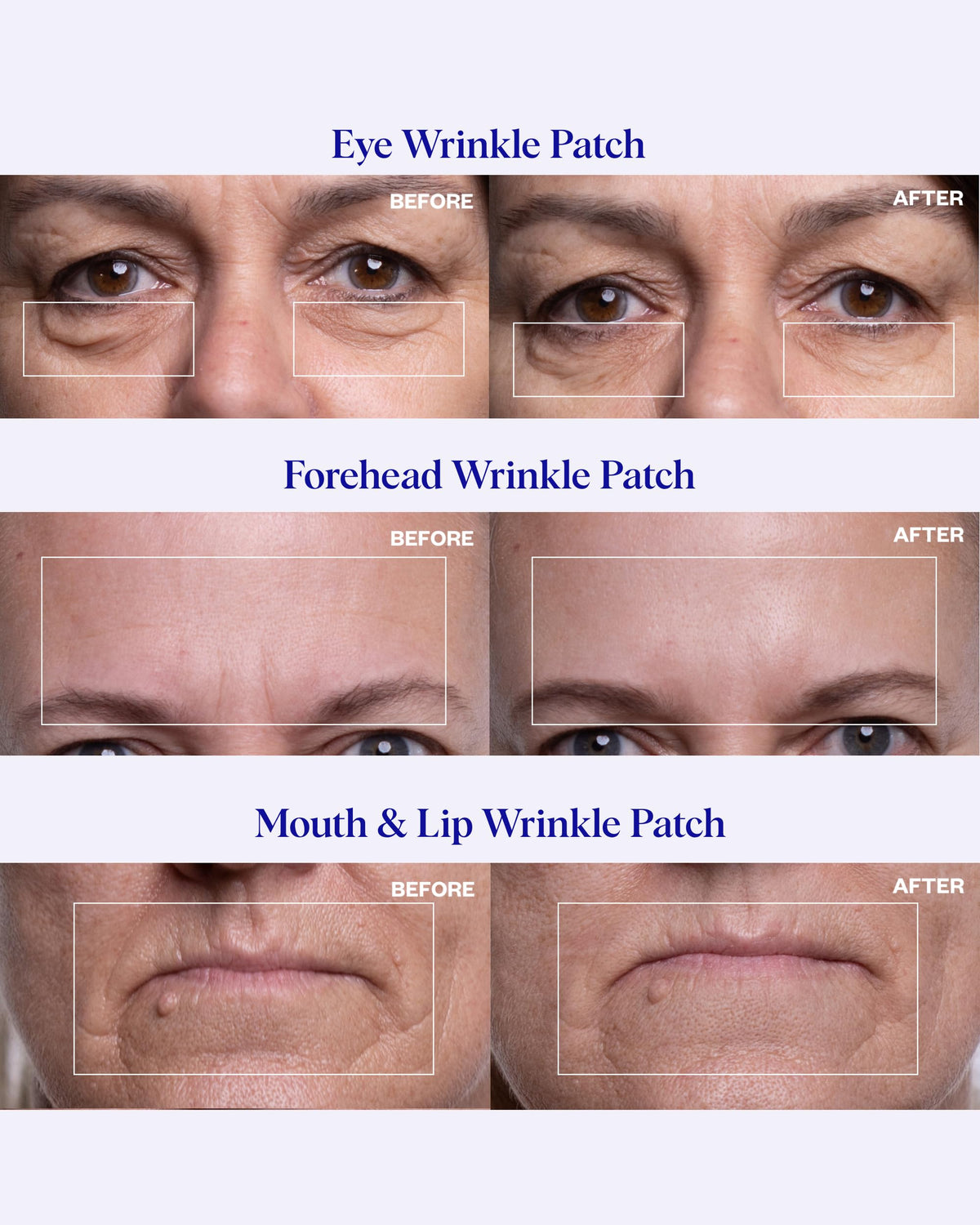 Wrinkles Schminkles Forehead Wrinkle Patches on brow for relaxed lines.