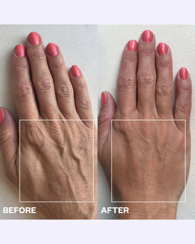 Wrinkles Schminkles overnight patches on skin promote hydration and gentle tightening.