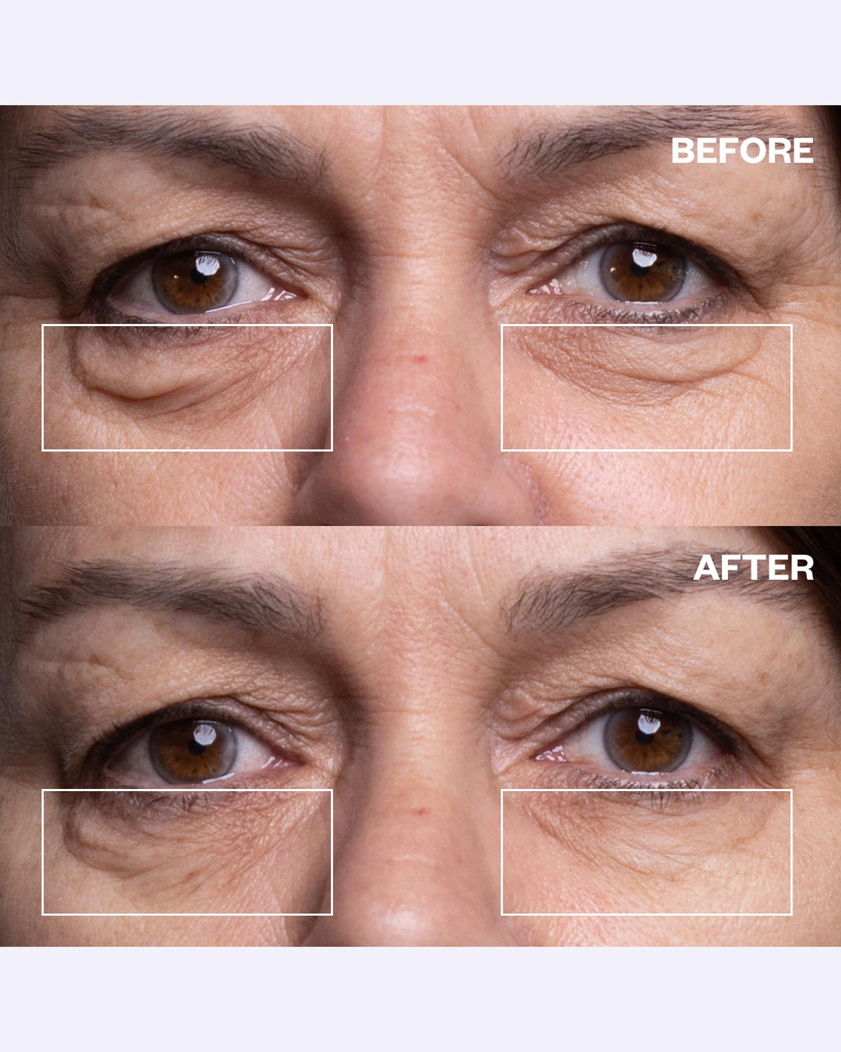 Wrinkles Schminkles Mouth Patch 2-Pack designed to prevent lip wrinkles.