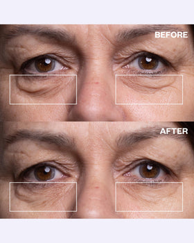 Patch applied to skin before bed targeting fine lines with lightweight feel.