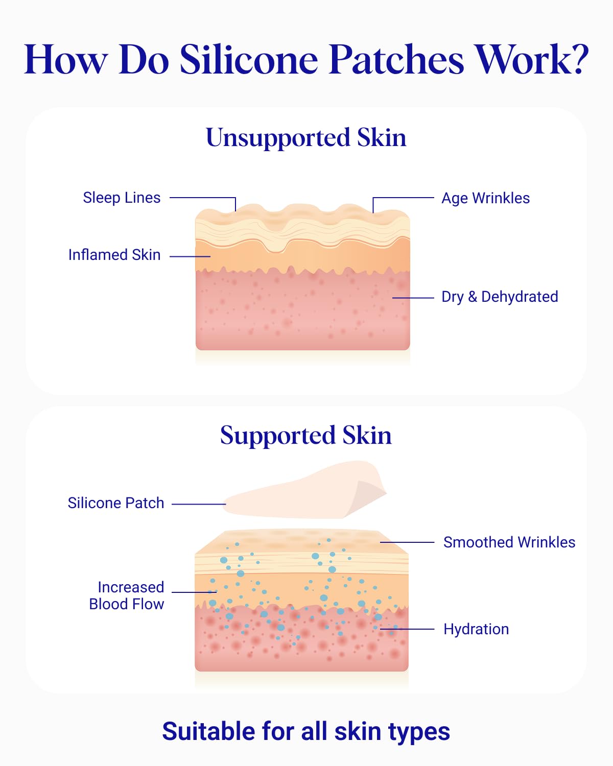 Simple skincare: Wrinkles Schminkles patches work on their own without extra products.