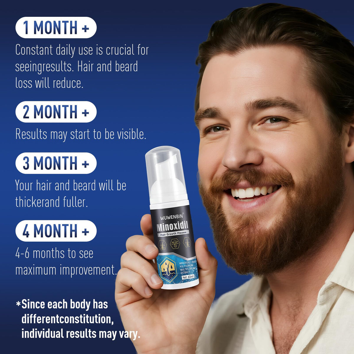 Wuwenbin Minoxidil for women supports thicker hair growth over time