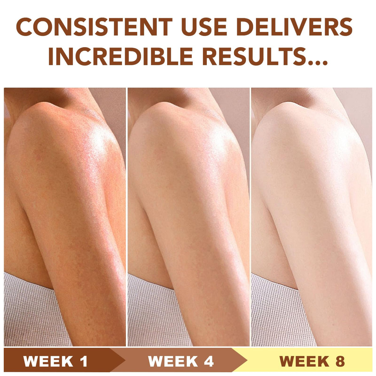 Xaarty Shea Butter elbow-application illustrates soothing relief for dry skin.