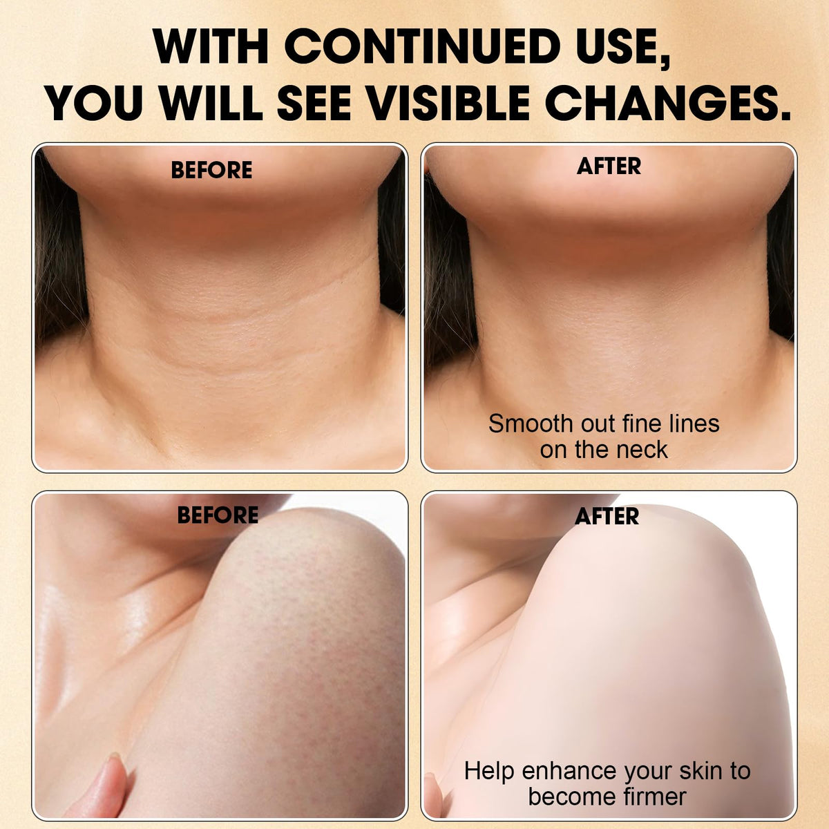 Xaninp Contouring Sculpted Silhouette – highlights neckline and limbs for a firmer look.