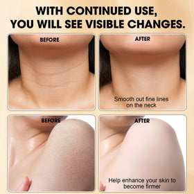 Xaninp Contouring Sculpted Silhouette – highlights neckline and limbs for a firmer look.