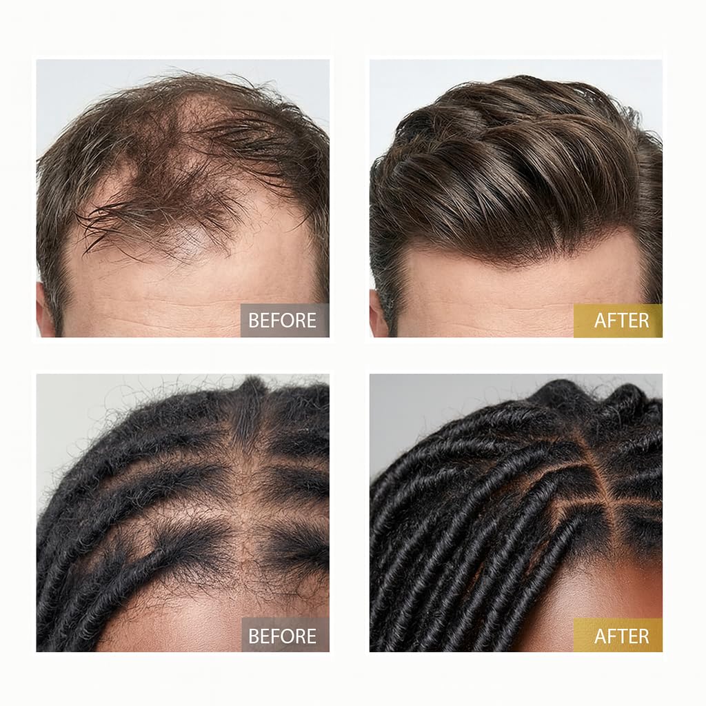 XILRVON scalp nourishment application suggesting potential for stronger strands.