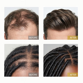 XILRVON scalp nourishment application suggesting potential for stronger strands.