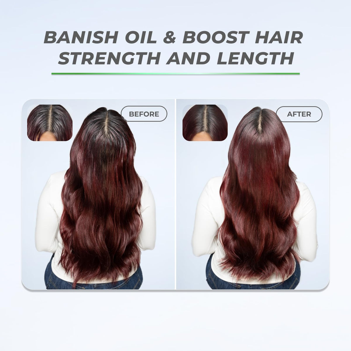 XMONDO Hair BOOST X Dry Shampoo 5 oz packaging on display