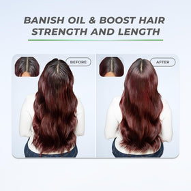 XMONDO Hair BOOST X Dry Shampoo 5 oz packaging on display