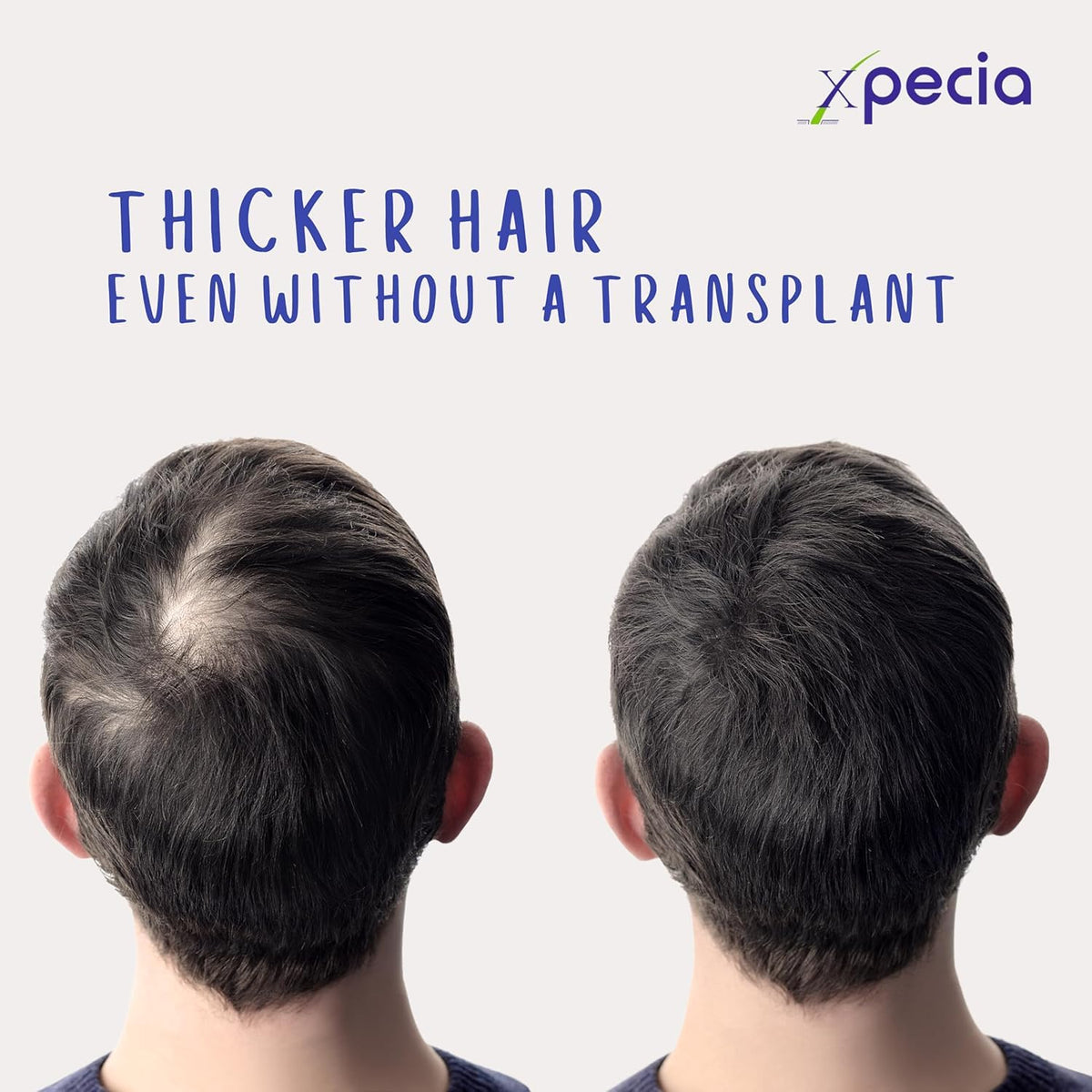 Lifestyle shot of a man using a routine with XPECIA for hair health