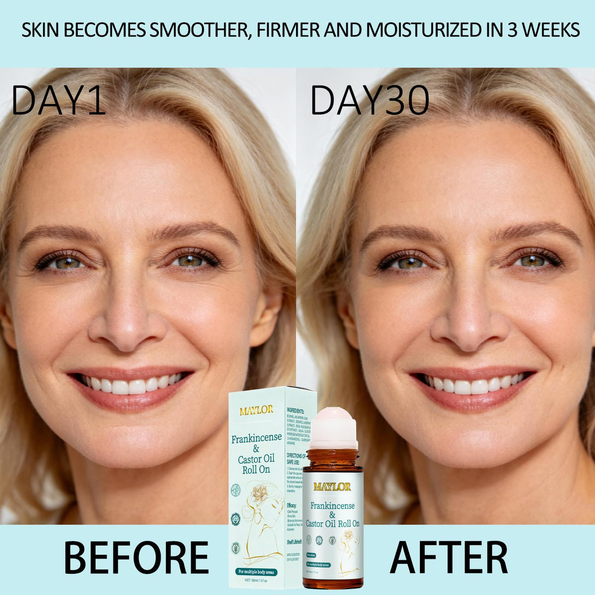 XUHUIT texture-softening roll-on helps achieve smoother-looking skin on body.