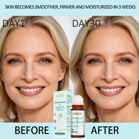 XUHUIT texture-softening roll-on helps achieve smoother-looking skin on body.