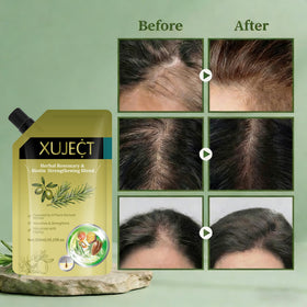 XUJECT ingredients image highlights rosemary and biotin for scalp nourishment.