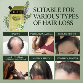 XUJECT two-pack packaging emphasizes value size for ongoing hair care routine.