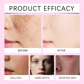 Xungess ingredients panel features allantoin and glutathione for hydration.