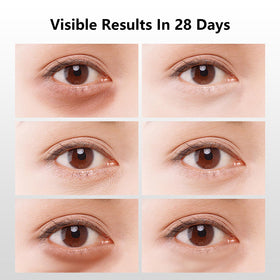 YAFUSIPE collagen and multi peptide eye patch shown hydrating the eye area.