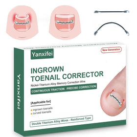Yanxifei dual nitinol ingrown corrector close-up showing gentle corrective action