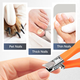 YAWOTA ingrown nails support for routine nail care