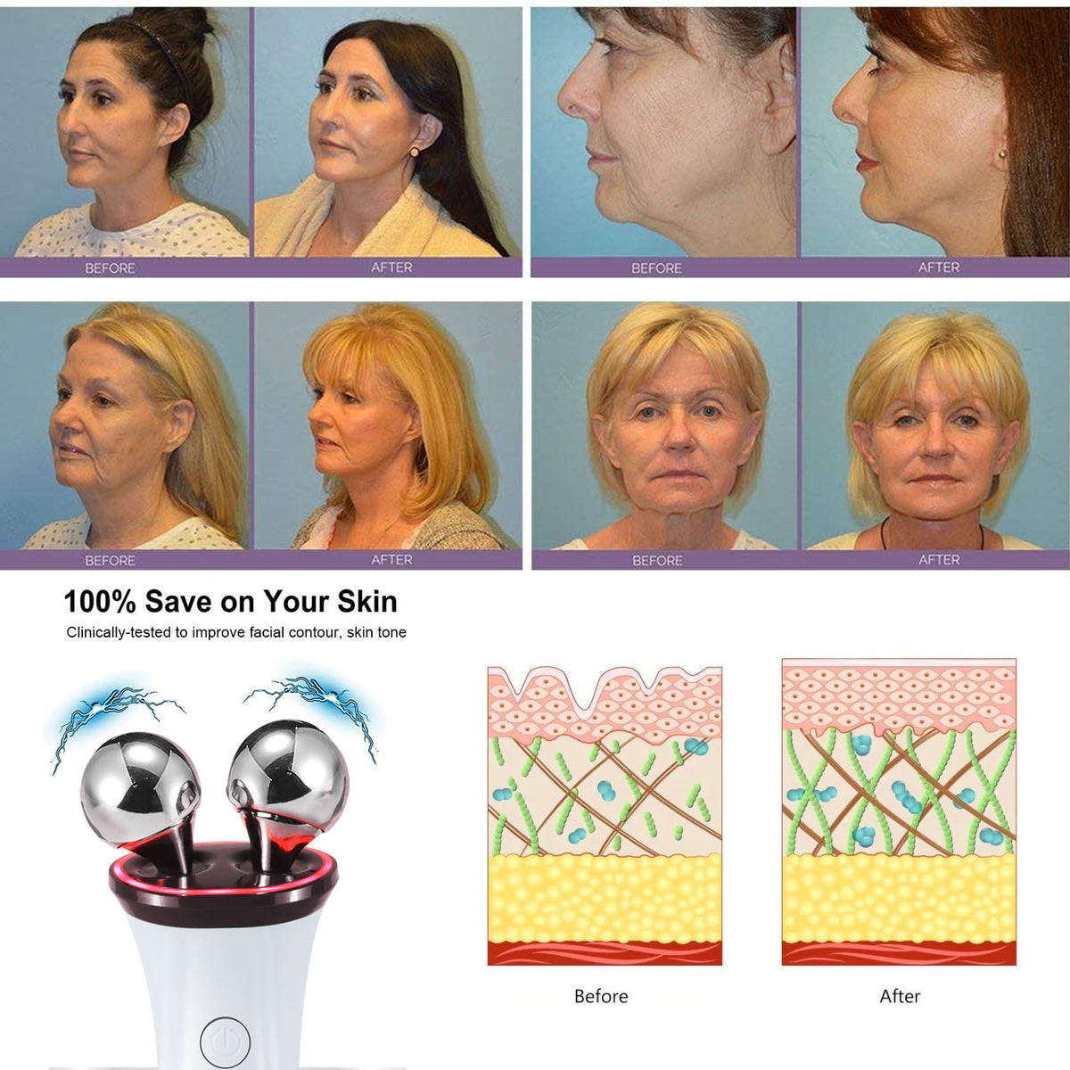 Yawpig microcurrent facial device USB charging port with indicator lights.