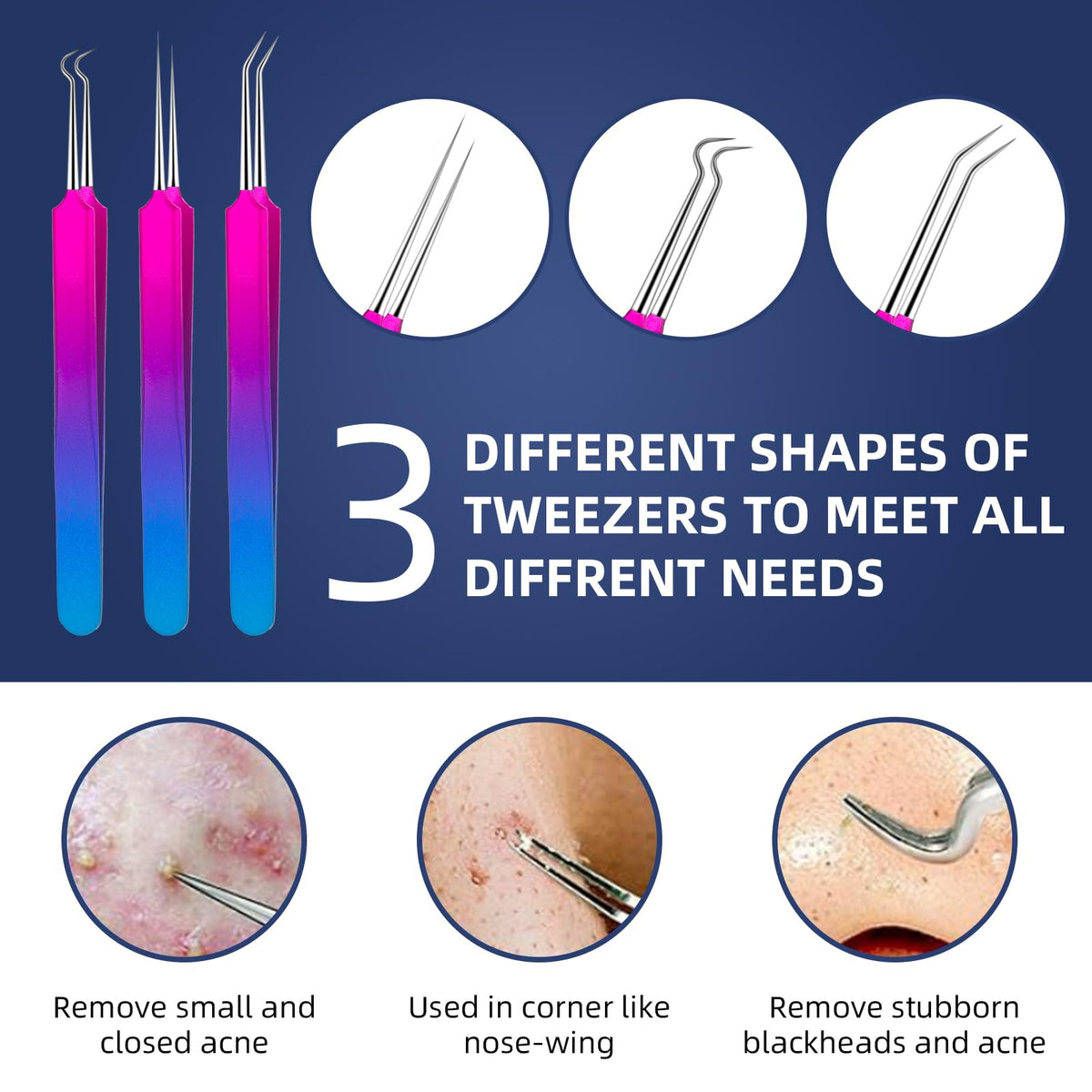 Ybaoo blackhead remover set ten tools helps tackle blackheads safely with a firm grip.