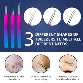 Ybaoo blackhead remover set ten tools helps tackle blackheads safely with a firm grip.