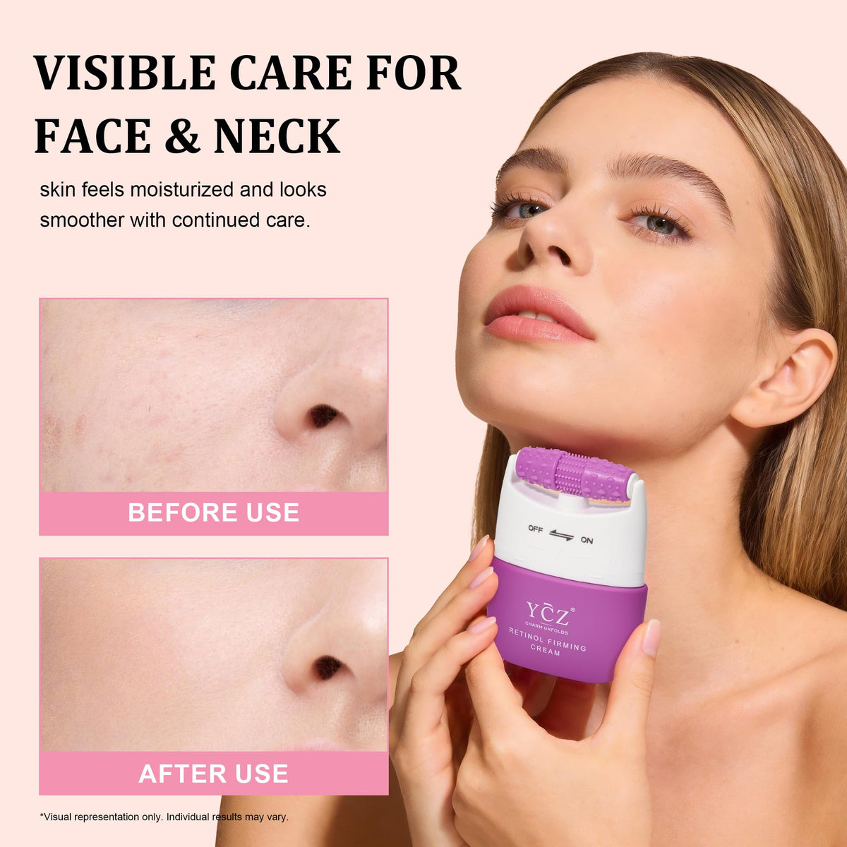 Ycz HPR retinoid cream texture swirl emphasizes gentle anti aging feel