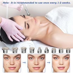 Yekavo home facial dermabrasion setup ready for salon-like sessions.
