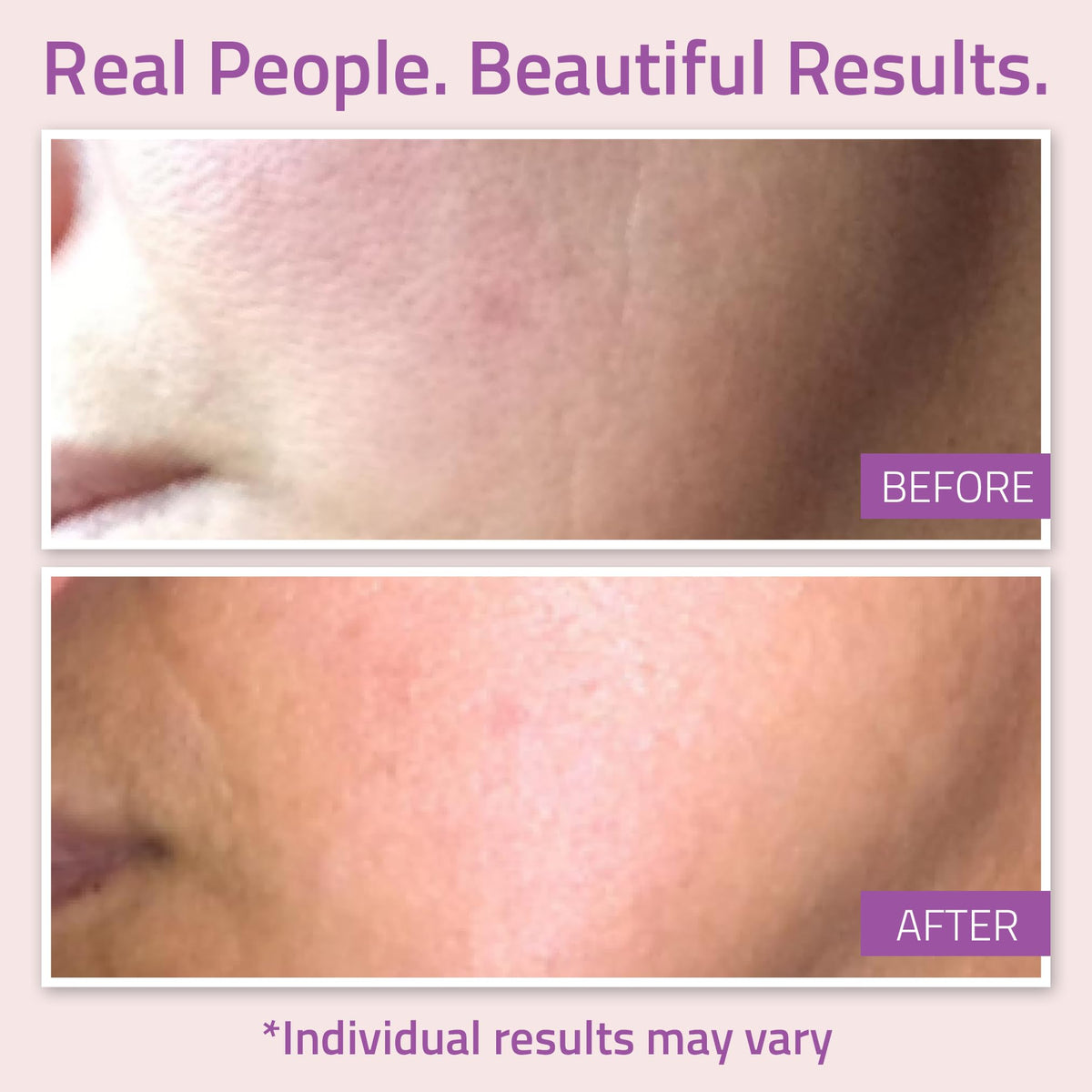 YEOUTH serum dispensing routine, ideal for nightly layering with other products.