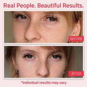 YEOUTH peptides eye cream targets firmer-looking under-eye skin.