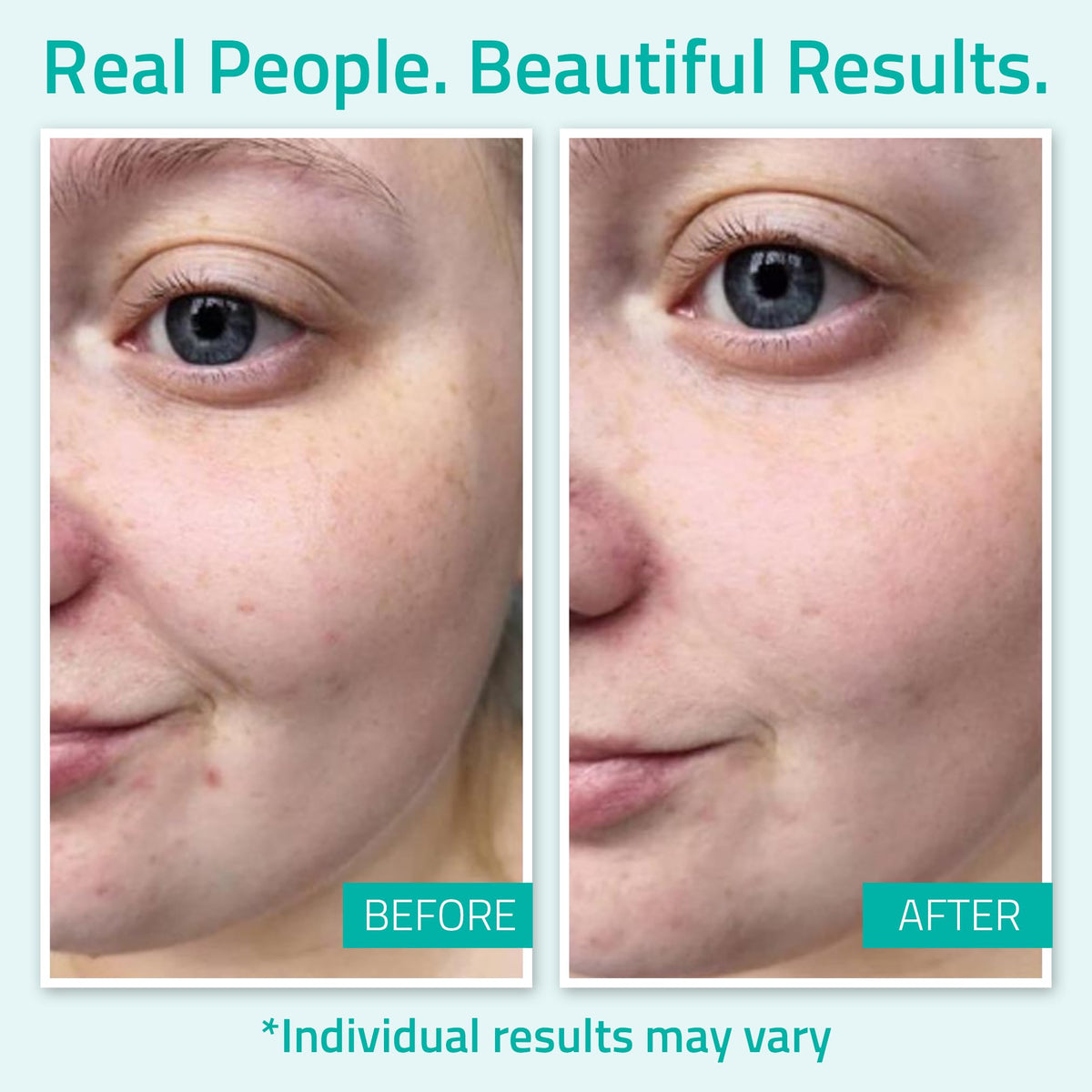 YEOUTH face serum application routine supports daytime and nighttime hydration.