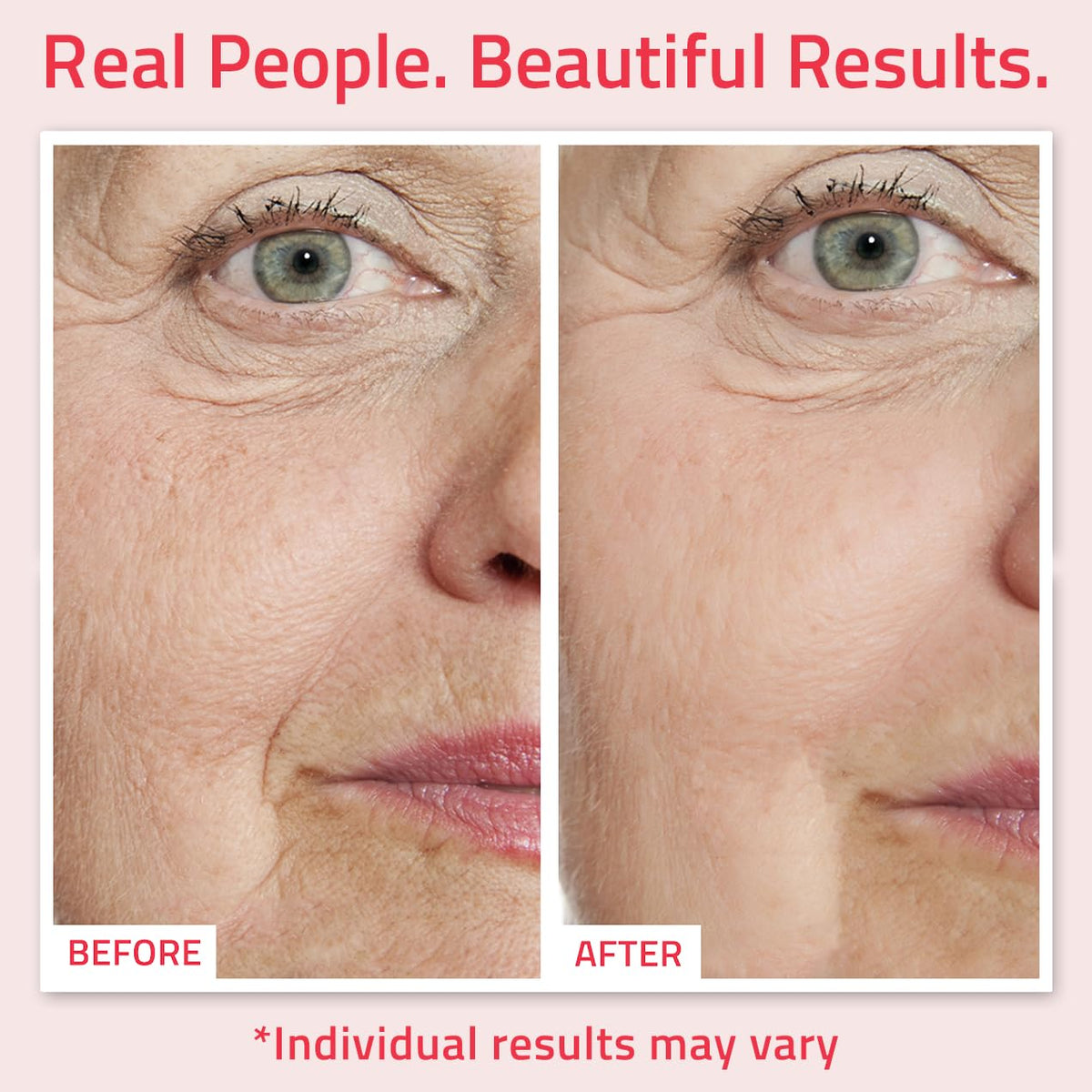 YEOUTH hyaluronic acid serum bottle delivering deep facial hydration