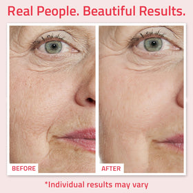 YEOUTH hyaluronic acid serum bottle delivering deep facial hydration