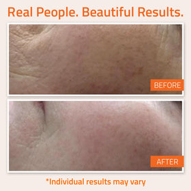 YEOUTH Hyaluronic Acid Serum packaging emphasizes hydration boost