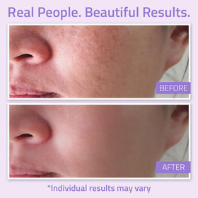 YEOUTH Hydrating Toner calming formula soothes irritation and dryness