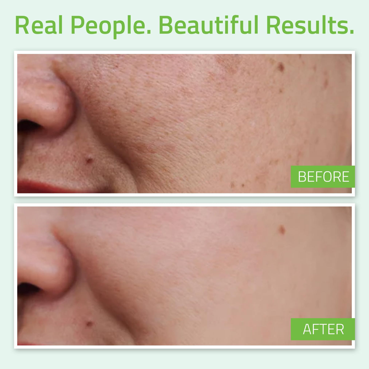 YEOUTH hyaluronic acid serum texture close-up with glistening finish.