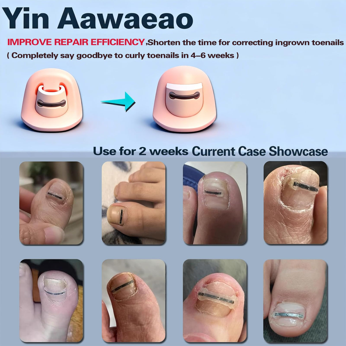 Yin Aawaeao replacement titanium patches pack for ongoing care