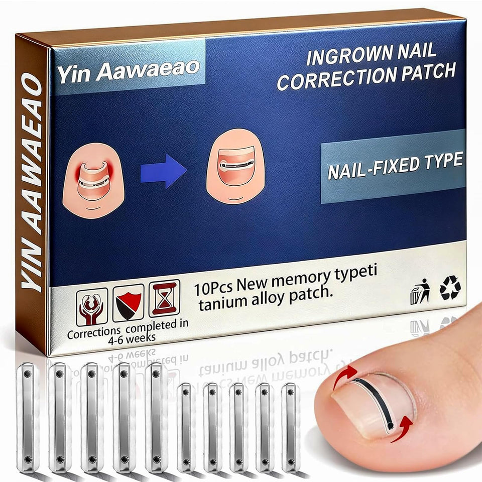 Yin Aawaeao titanium alloy ingrown patches ready for at-home correction of curved nails