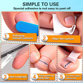 Yin Aawaeao universal-fit design adapts to curved nails