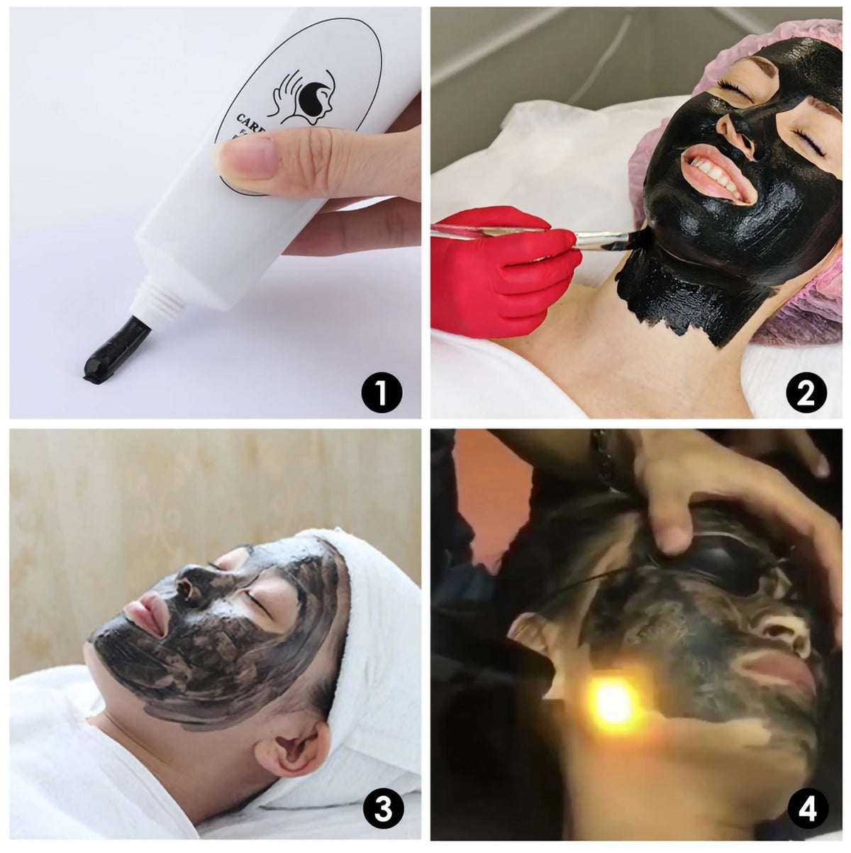 YMEYFAN carbon peeling gel nose-forehead application highlights oil control and pore refinement.