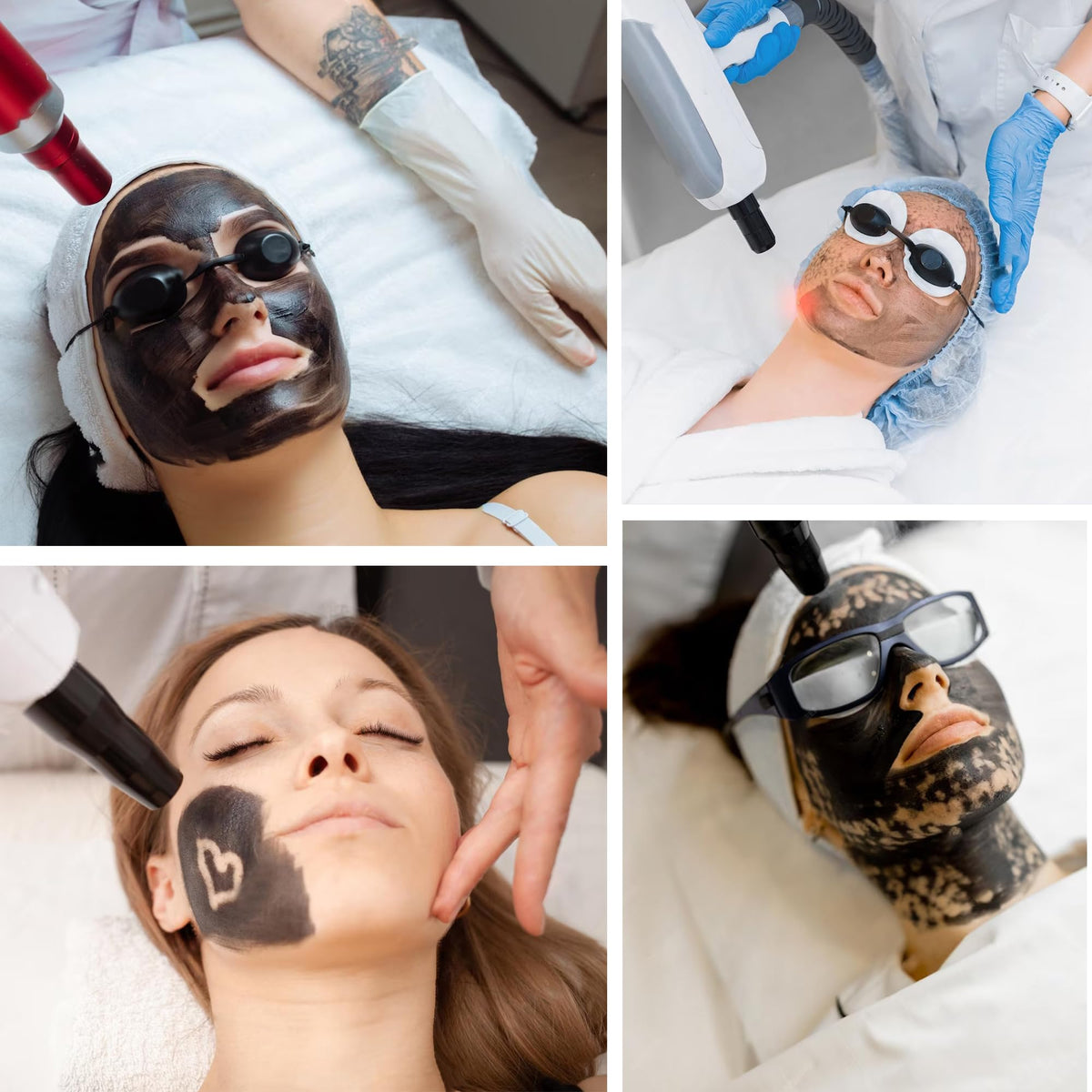 YMEYFAN cooling gel after laser treatment hydrates and calms skin.