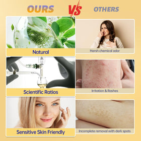 Youggle cheeks application, gentle hair removal across cheeks without harsh pulling.