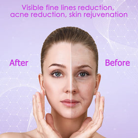 YourMate curved tube works on the nasal groove for refined contour.