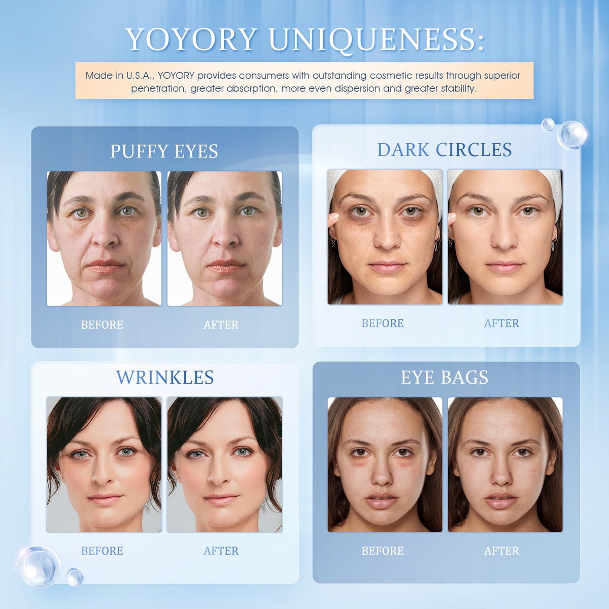YOYORY eye patches with hyaluronic acid and collagen for deep hydration
