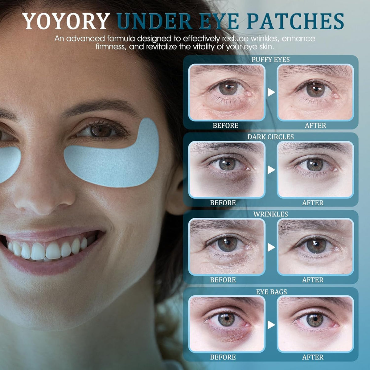 YOYORY patches during application illustrate soothing, cooling contact under the eyes.