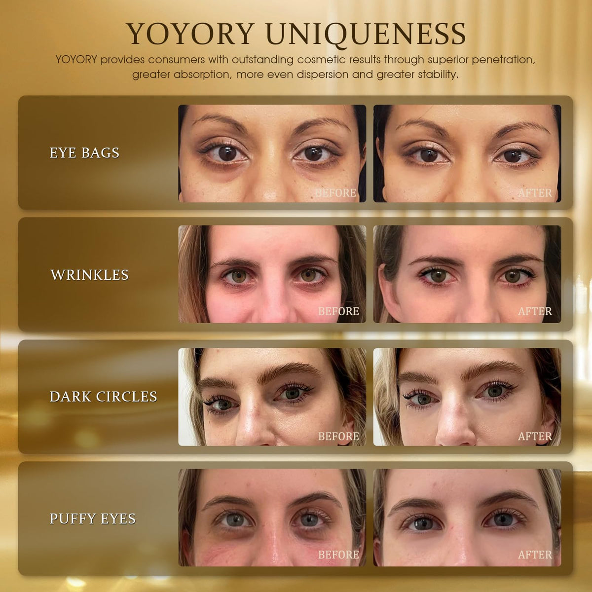 YOYORY spa-quality eye care packaging signals premium, cruelty-free formula