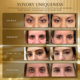 YOYORY spa-quality eye care packaging signals premium, cruelty-free formula