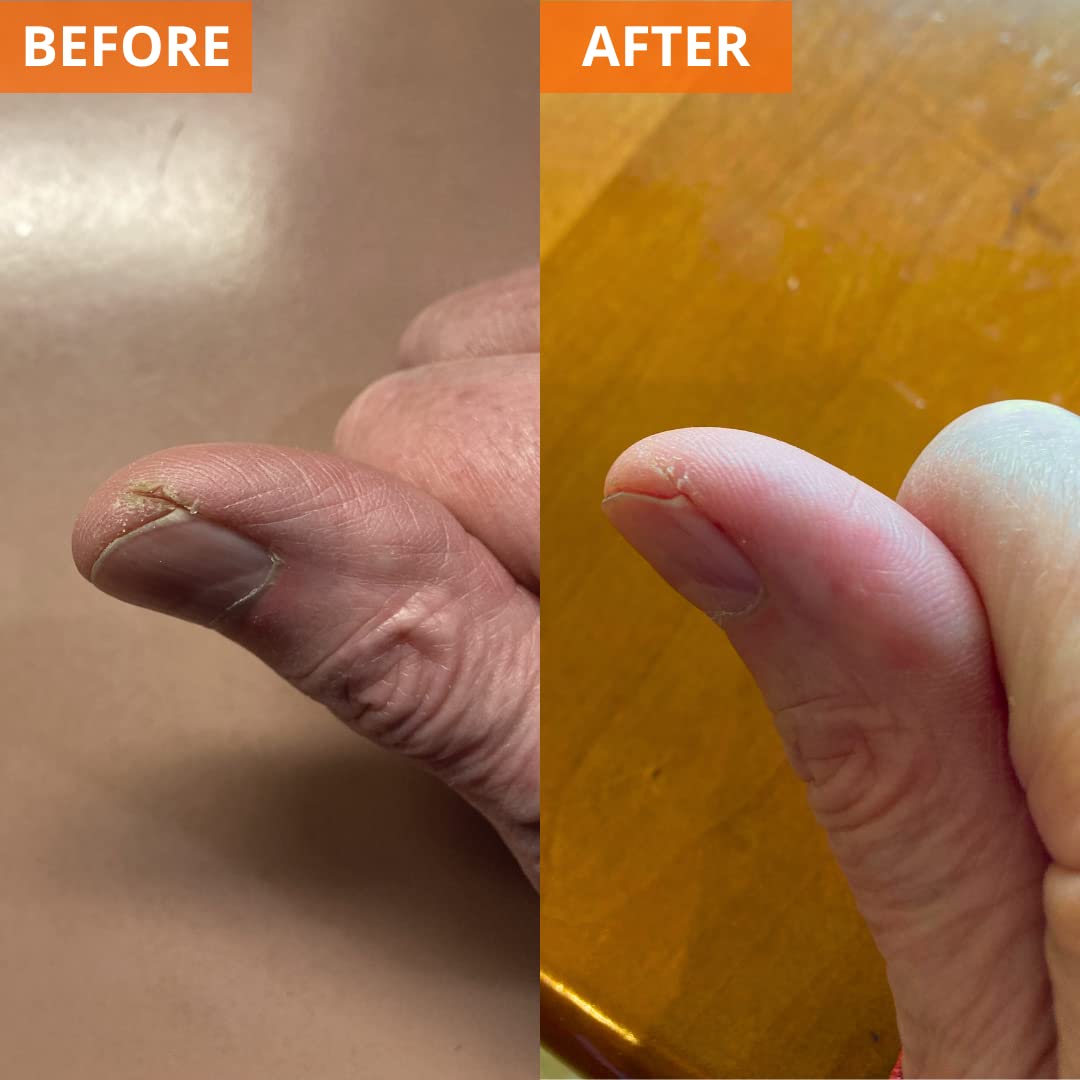 Yu-Be cream applied to hand demonstrating quick absorption.