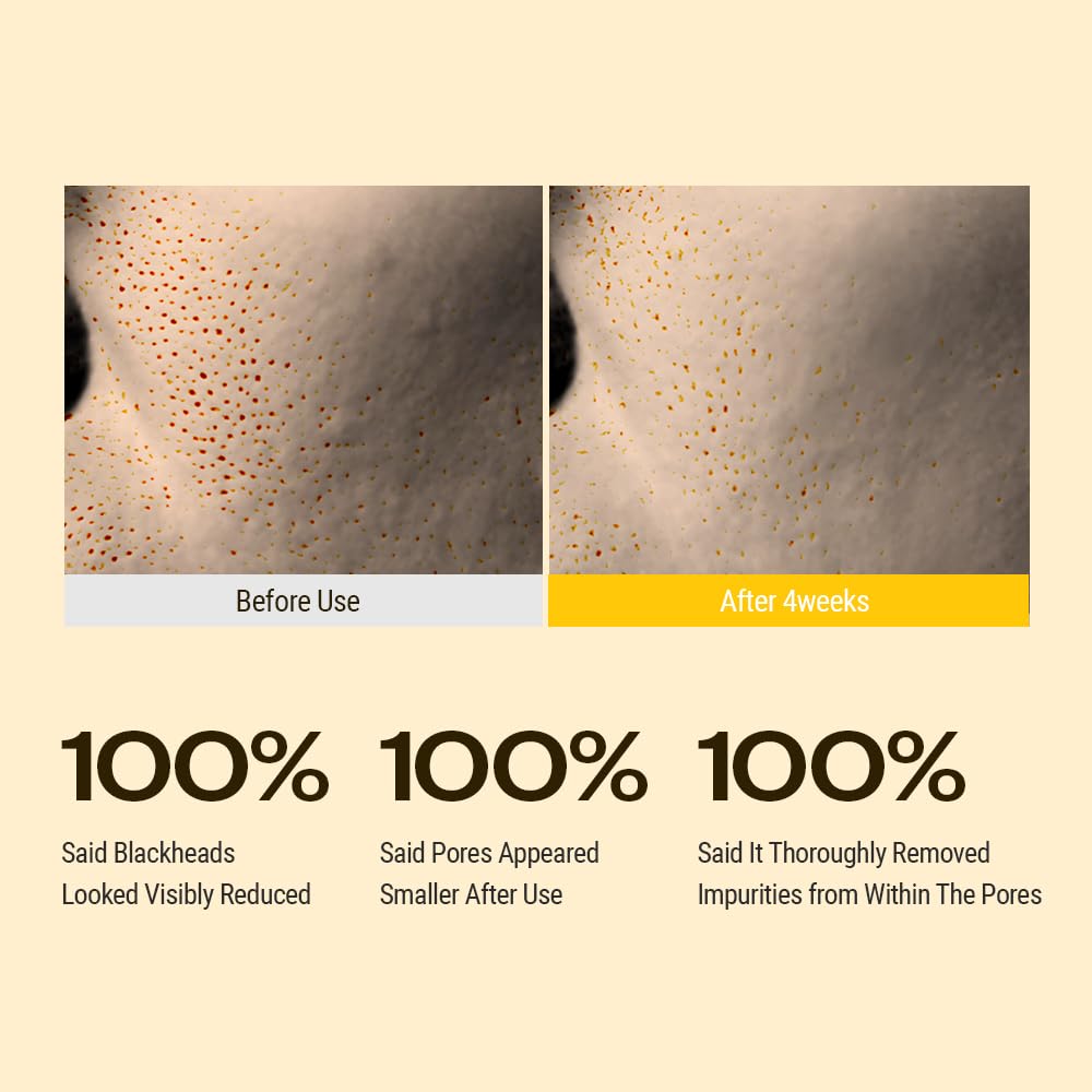 YUMU Coix Seed Deep Pore Cleansing Oil pores refinement image for smoother skin texture.