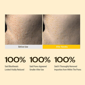 YUMU Coix Seed Deep Pore Cleansing Oil pores refinement image for smoother skin texture.