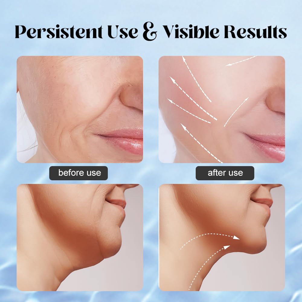 YUNRUO neck massager targets chin and jaw for smoother silhouette.